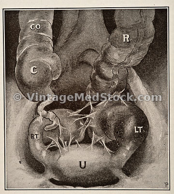 Proctology