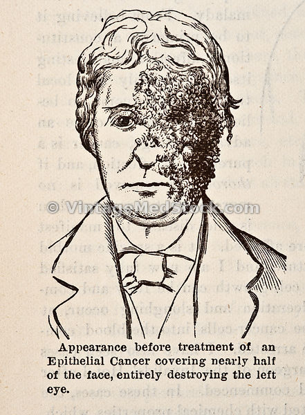 Diseases