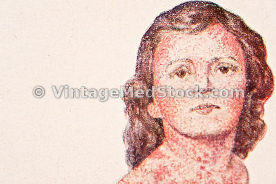 Infectious Disease