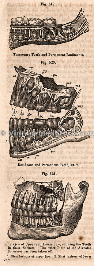 vms-11