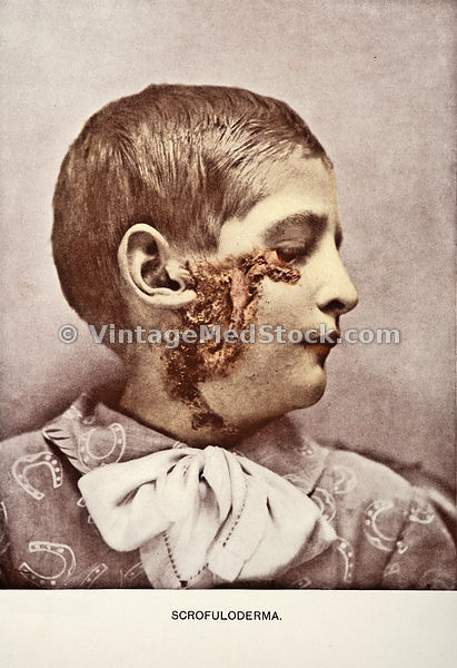 Dermatology