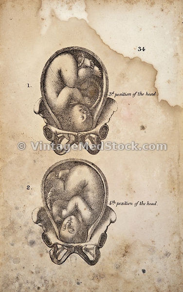Reproductive