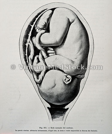 OB/GYN